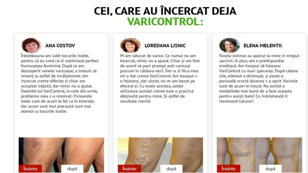 Veniselle prospect - ce este - compoziție - ce contine - ingrediente - cum functioneaza - cum sa o ia - dozaj